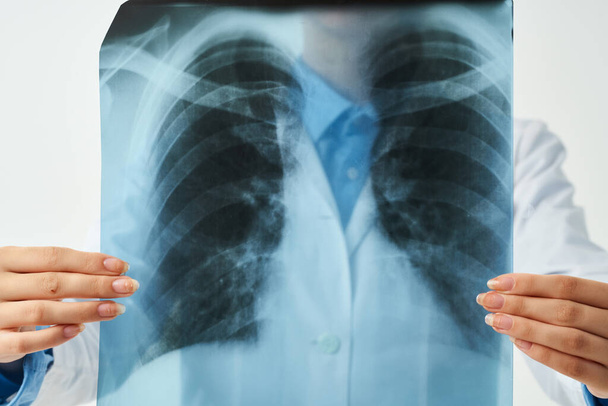 x-ray of the lungs close-up examination light background - Photo, Image