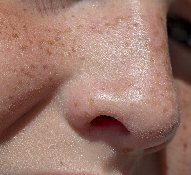 Nose teen girl close up front view - Fotografie, Obrázek