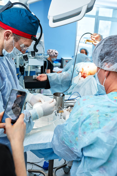 Chirurgiens pendant la chirurgie avec implants mammaires dans les mains, installation d'implants mammaires, chirurgie. Chirurgie plastique, correction mammaire, mammoplastie. - Photo, image