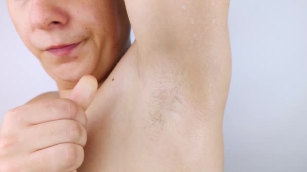 The man shows his sweaty armpits to the camera. Close-up of sweat drops. Gland problems. Hyperhidrosis, increased sweating, anhidrosis. Concept of treatment for violations of the mechanisms secretion. - Footage, Video