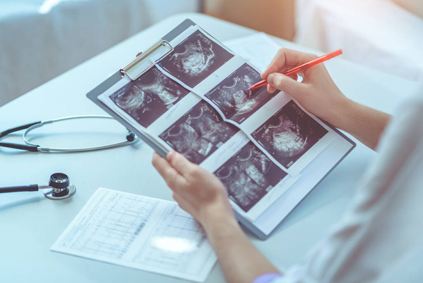General practitioner examines ultrasound images of patient during a health check and consultation. Healthcare and medicine - 写真・画像