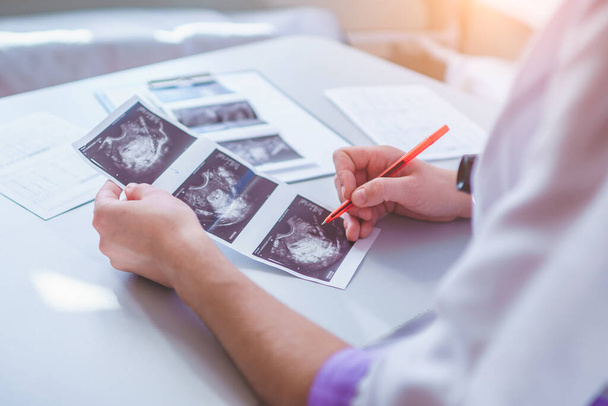 General practitioner examines ultrasound images of patient during a health check and consultation. Healthcare and medicine. Diagnosis and treatment of the disease - Foto, Bild