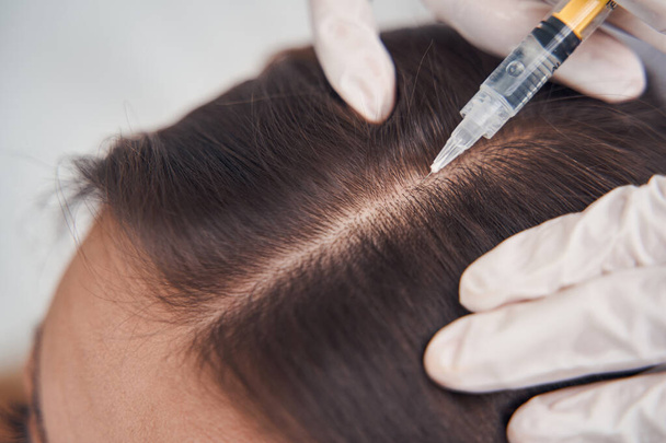 Woman doing head mesotherapy in beauty clinic - Foto, imagen