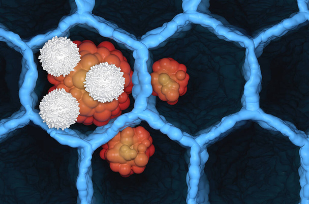T-cellen vallen kleine-cel longkanker tumor microbiologie 3d illustratie bovenaanzicht - Foto, afbeelding