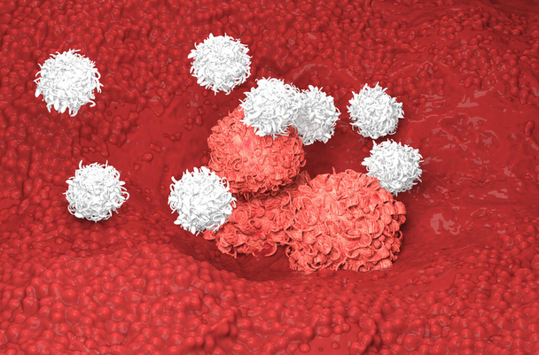 Les cellules cancéreuses du sein se développent puis sont attaquées par des cellules T Illustration 3D - Photo, image