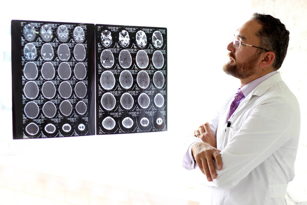 Homme médical mature élégant aux yeux clairs avec barbe, moustache et lunettes, analysant les radiographies cérébrales - Photo, image