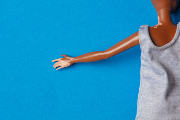 black girl doll hold hand with viteligo - Fotografie, Obrázek