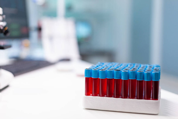 Медицинский вакутант с образцом крови, стоящим на столе во время фармацевтического осмотра - Фото, изображение