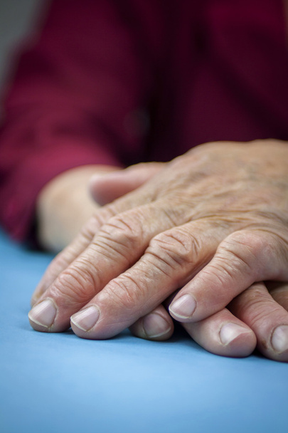 Руки ревматоидного артрита
 - Фото, изображение