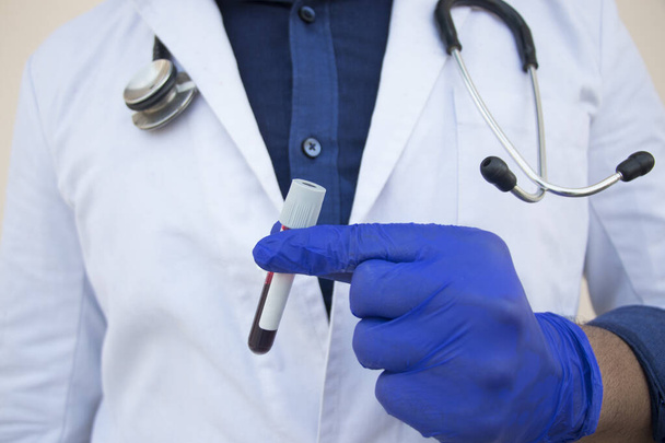 Arzt hält Blut im Reagenzglas - Foto, Bild