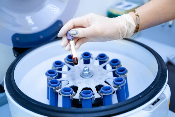 Scientist putting samples into centrifuge. Modern biotechnology equipment. - Photo, image