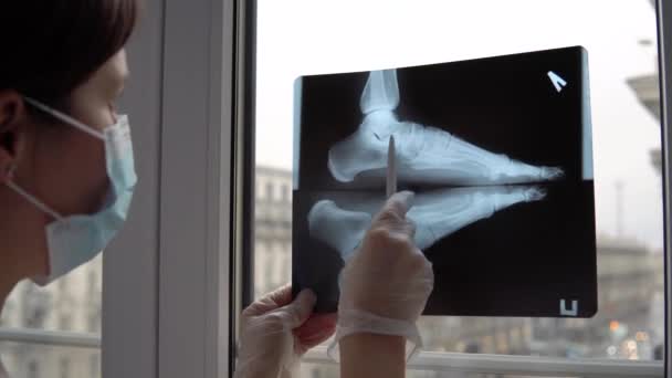 Doktor zkoumá rentgenový film zlomené nohy - Záběry, video