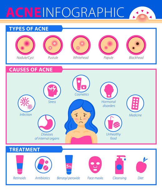 Akne-Arten, Krankheitsursachen, Behandlung. Infografik zu Akne. - Vektor, Bild