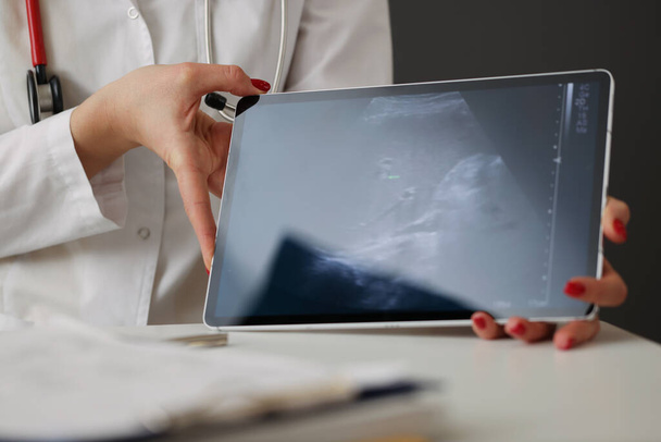 Врач показывает ультразвуковое сканирование брюшной полости на цифровом планшете вблизи клиники - Фото, изображение