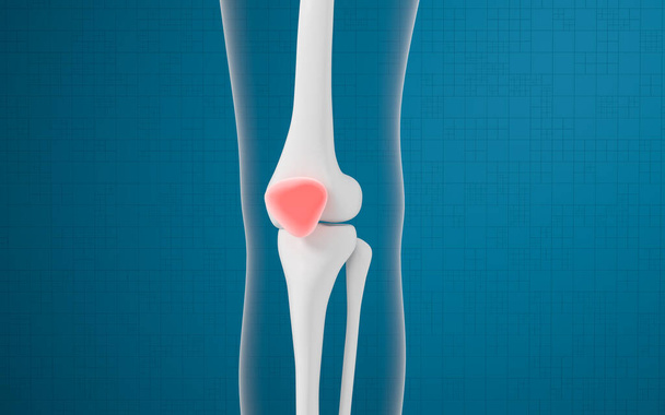 Bein- und Knieverletzungen, 3D-Darstellung. Digitale Computerzeichnung. - Foto, Bild