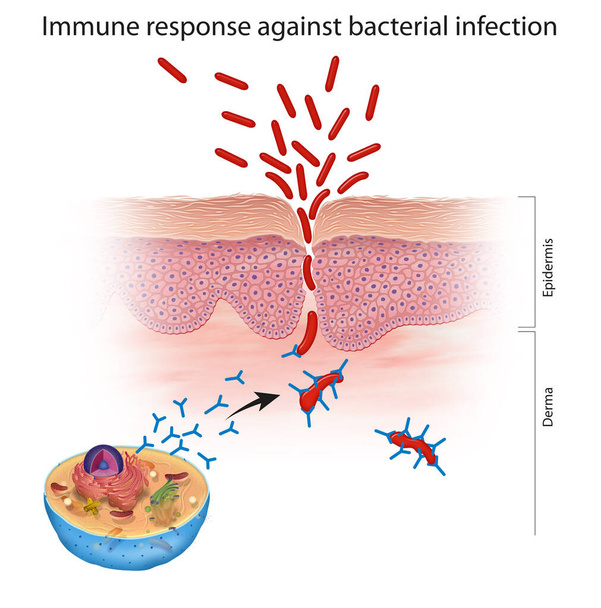 Immune response against bacterial infection - Photo, Image