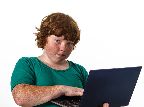 Freckled red-hair boy with laptop. - Zdjęcie, obraz