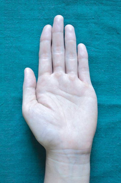 Бледная ладонь на поверхности руки. Анемическая рука азиата, китайца. - Фото, изображение
