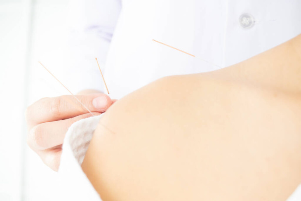 Close up of hands doing acupuncture with at patient shoulder - Photo, Image