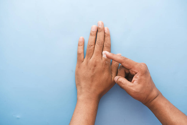  Close up of man hand applying petroleum jelly on hand on blue  - Foto, afbeelding