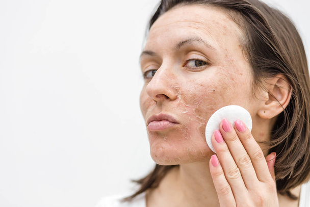 Close up photo of woman cleaning face with cosmetic sponge. - 写真・画像
