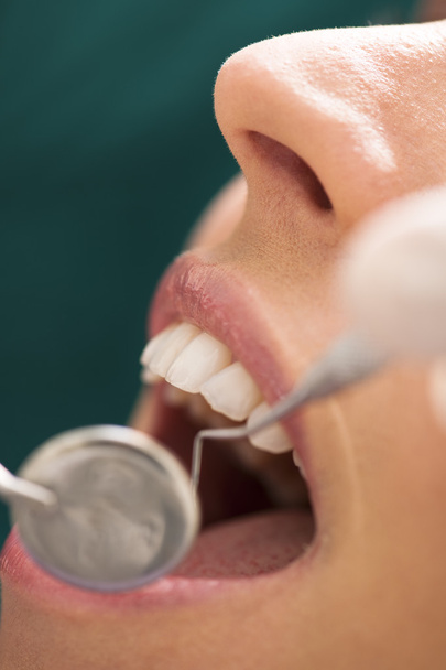 Young woman receiving dental care - Photo, Image