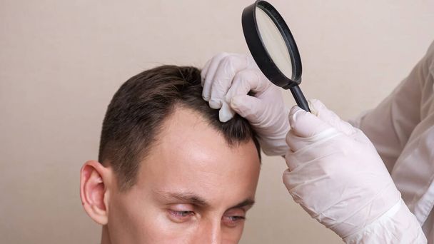 trabajador médico en guantes y con una lupa examina la cabeza de un hombre calvo de cerca - Foto, Imagen
