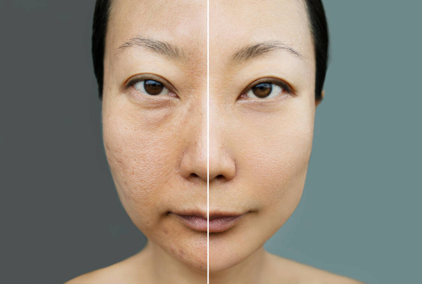 Concept de rajeunissement de la peau. Avant et après l'opération cosmétique. Crème blanchissante pour femmes asiatiques. - Photo, image