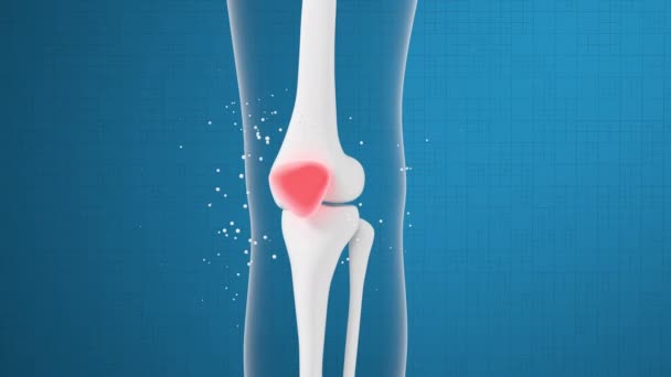 Heal leg bones and knees, 3d rendering. - Footage, Video