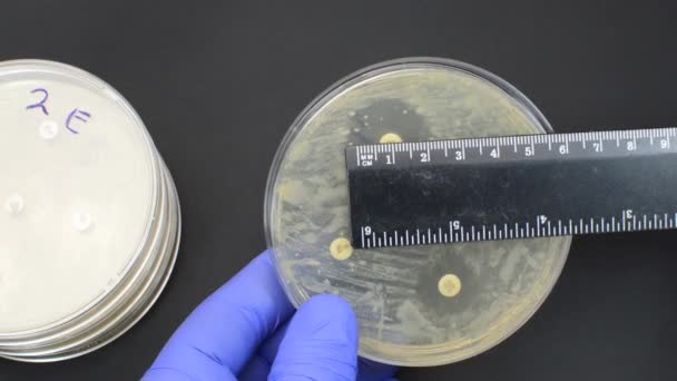 az antimikrobiális rezisztencia vizsgálatának eredményét vonalzóval történő méréssel - Felvétel, videó