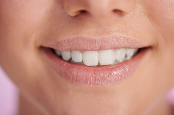 Primer plano de sonrisa con los dientes en la cara de la mujer. Tema dental - Foto, Imagen