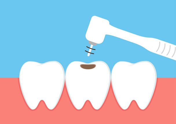 Teeth cartoon vector. dental equipment vector. Tooth cavity. - Vector, Image