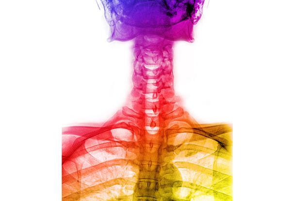 Colonna vertebrale T-L a raggi X colorati (colonna vertebrale toracico-lombare
) - Foto, immagini