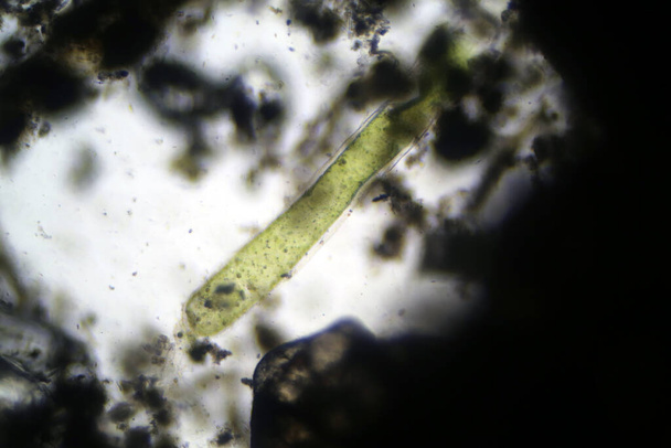 Μικροσκοπική ζωή σε μια σταγόνα στάσιμο νερό λίμνης πάπιας, όπως φαίνεται μέσα από ένα βιολογικό μικροσκόπιο σε 100X το πραγματικό του μέγεθος. Το νερό της λίμνης ενώνεται με ζωή αόρατη με γυμνό μάτι.. - Φωτογραφία, εικόνα