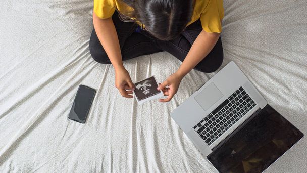 An overhead shot of a pregnant female sitting on the couch with laptop and ultrasound photo - Фото, изображение