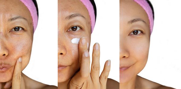 肌の若返りの概念。化粧品操作の前と後。アジアの女性のための白いクリーム. - 写真・画像