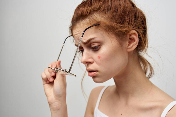 жінка з прищами на обличчі гігієна лікування
 - Фото, зображення