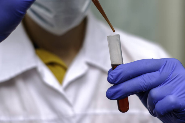 um médico com um casaco branco e luvas azuis tira sangue de um tubo de ensaio com uma pipeta para análise. Foto de alta qualidade - Foto, Imagem