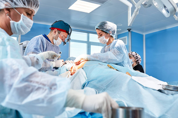 Operaci provádí lékařský tým - série snímků souvisejících s operací. Skutečný moderní, provozní poplatek, boj o život - Fotografie, Obrázek