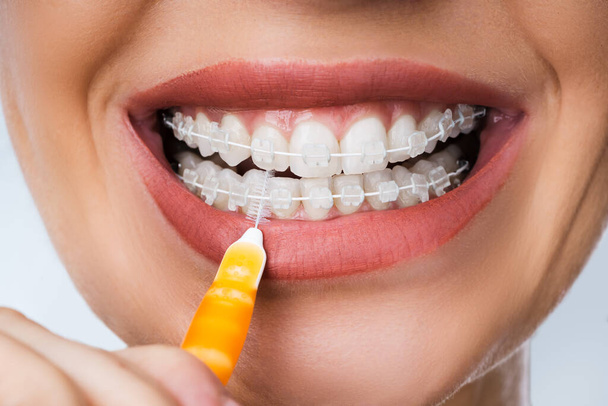 Female Cleaning Dental Brackets In Mouth Using Toothbrush - Fotó, kép