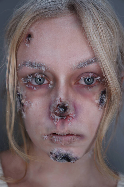 young blond woman with frostbite sfx makeup - Photo, Image