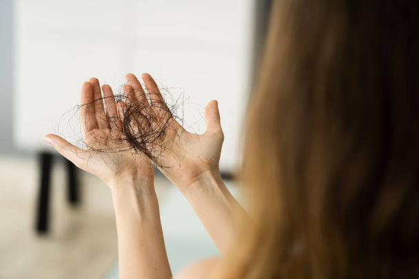 Young Woman Holding Loss Hair In Hands - Valokuva, kuva