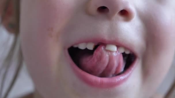 Kid touches upper middle tooth with tongue and lost hole - Footage, Video