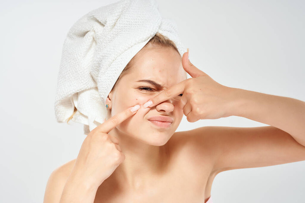 woman with bare shoulders squeezes out pimples on dermatology discontent face - Fotó, kép