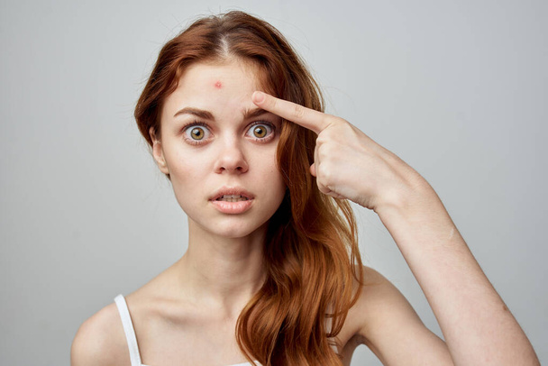 woman with a pimple on the face in  Studio. High quality photo - Photo, Image
