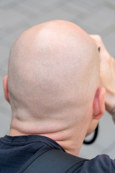 Kafasının arkasında tıraşlı bir adam. Yetişkin bir erkeğin yuvarlak kafası..  - Fotoğraf, Görsel