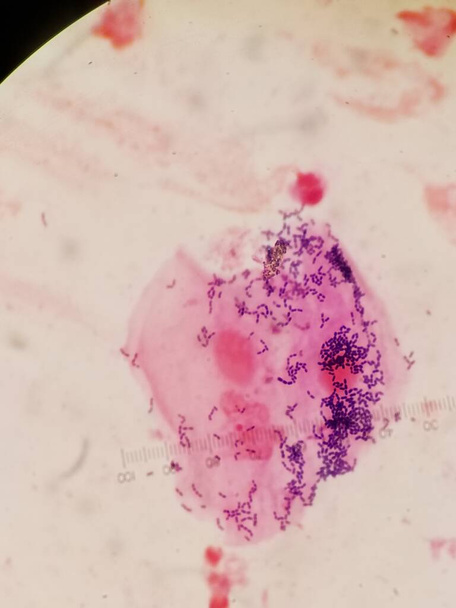 Célula epitelial bronquial con contaminación bacteriana oral - Foto, imagen