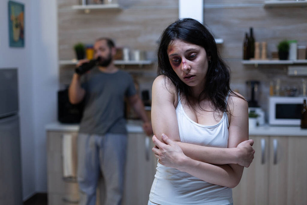 Depressed bruised woman being victim of domestic violence - Photo, Image