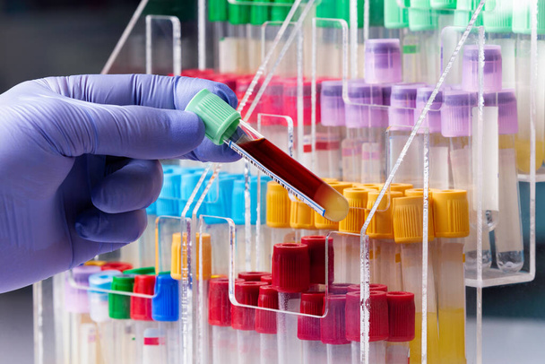 血液検査のための血液サンプルを保持している病院/医師の血液バンク研究室で血液サンプルチューブを持つ技術者血液検査室で - 写真・画像