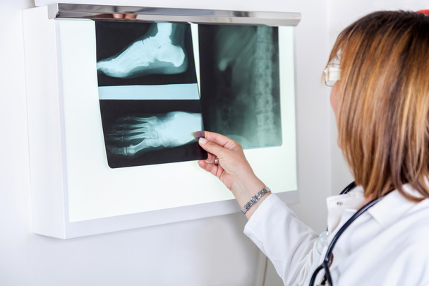 Female Doctor Looking At Patients X-ray - Foto, afbeelding